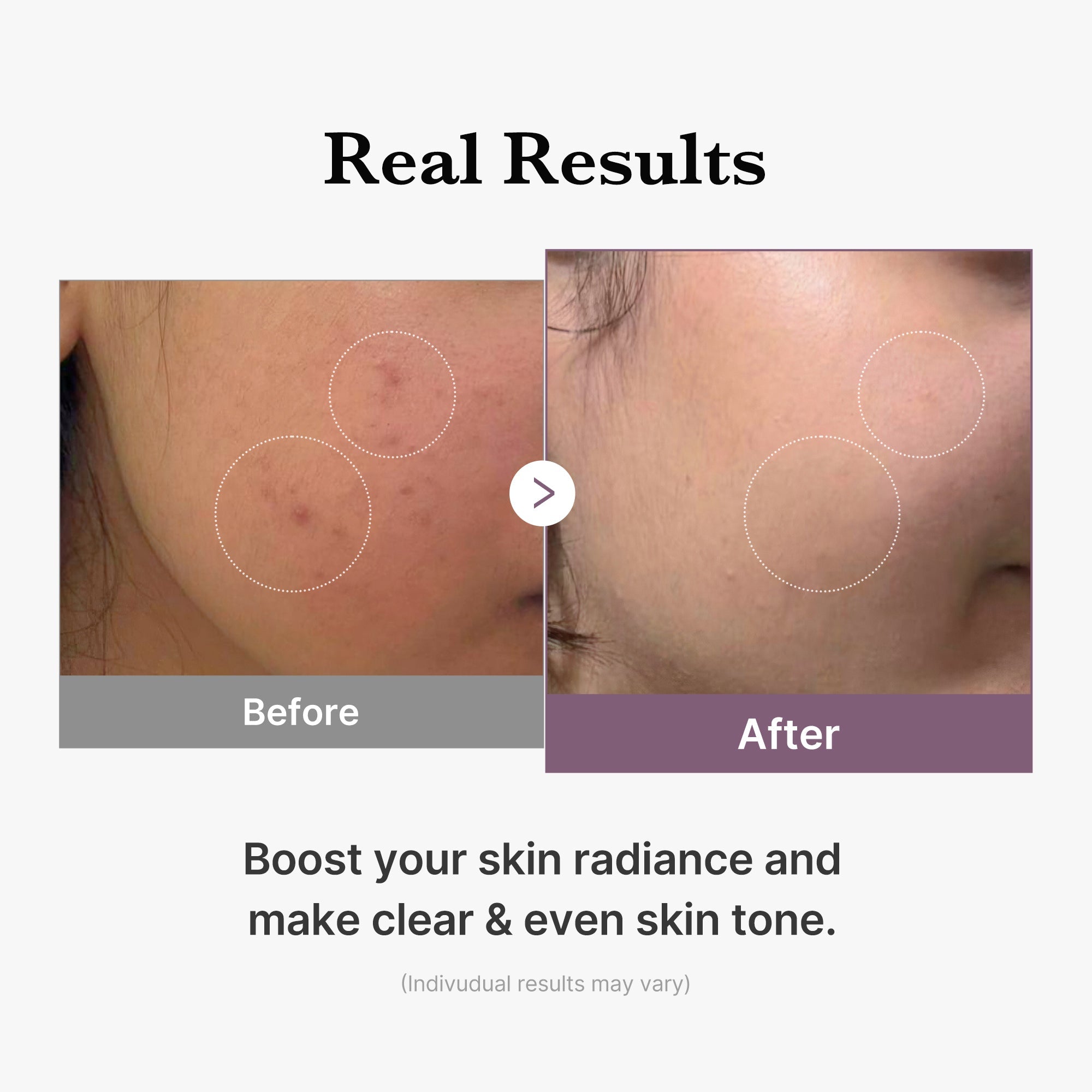 [GIFT] AGE-R Glutathione Glow Milk Toner