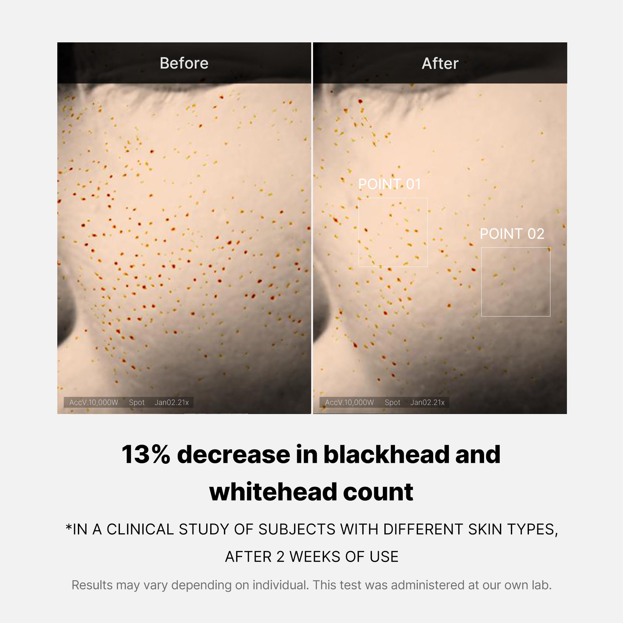 [GIFT] Zero Pore One-day Peptide Serum