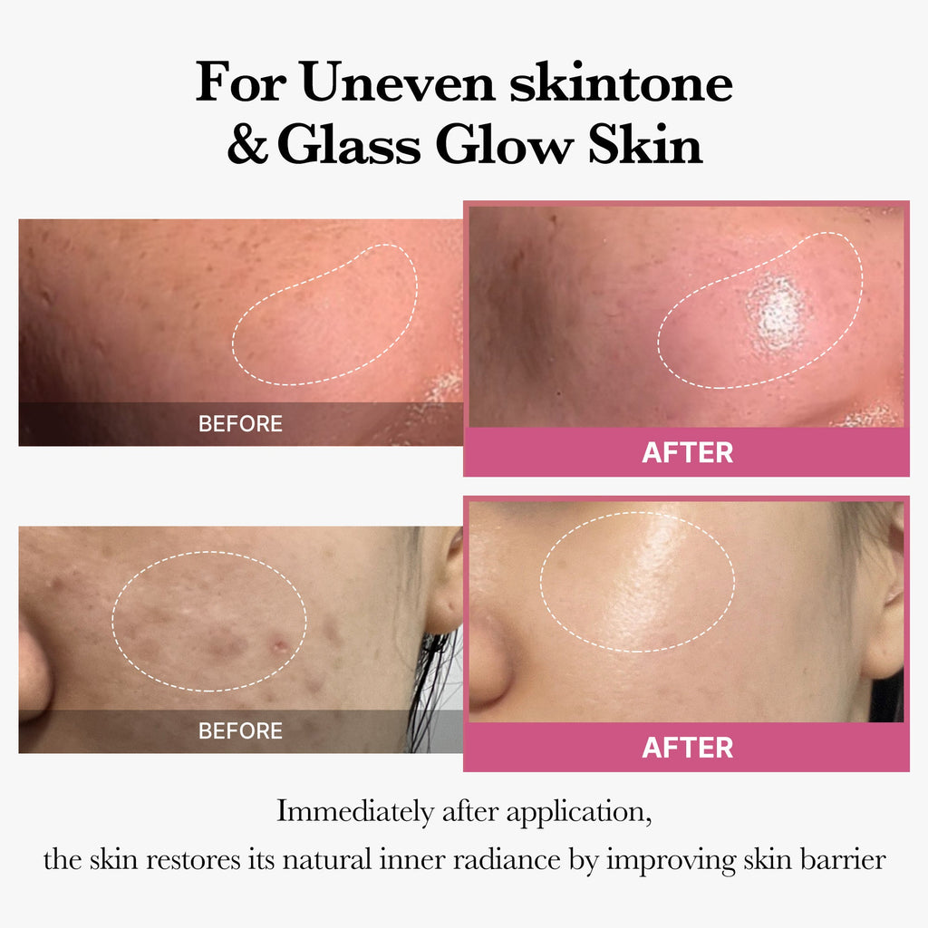 [Tati's Exclusive] Plump Perfection Set